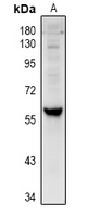 1 - Anti-Cytochrome P450 4V2 Antibody AP53990