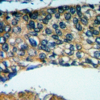 19 - Anti-Placental lactogen Antibody AP53997