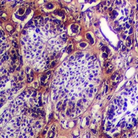19 - Anti-Cytokeratin-5/6 Antibody AP53999