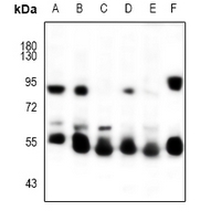 1 - Anti-Cytokeratin-5/6 Antibody AP53999