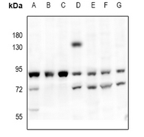 1 - Anti-PKC-pan Antibody AP54000