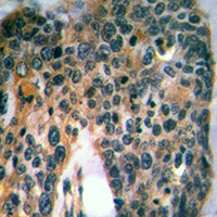 19 - Anti-Mast Cell Tryptase Antibody AP54002