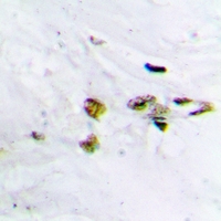19 - Anti-CaMK2 alpha/beta/delta (Phospho-T305) Antibody AP54004
