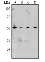1 - Anti-CaMK2 alpha/beta/delta (Phospho-T305) Antibody AP54004