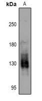 1 - Anti-PKN1/2 (Phospho-T774/816) Antibody AP54005