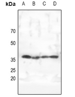 1 - Anti-AMPK gamma 1/2/3 Antibody AP54007