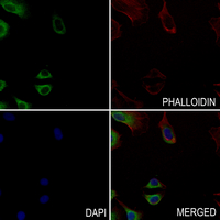 3 - Anti-MYO10 Antibody AP54008