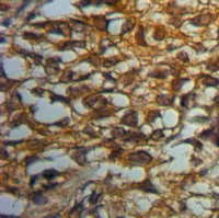 19 - Anti-MYO10 Antibody AP54008