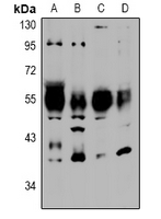 1 - Anti-NTR2 Antibody AP54009