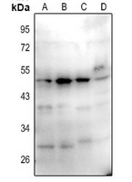 1 - Anti-CD1a/b Antibody AP54012