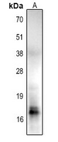 1 - Anti-Histone H2B (Acetyl-K85) Antibody AP54016