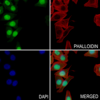 3 - Anti-VEGFR2/3 (Phospho-Y1054/Y1063) Antibody AP54017