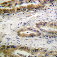 19 - Anti-VEGFR2/3 (Phospho-Y1054/Y1063) Antibody AP54017