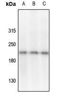 1 - Anti-VEGFR2/3 (Phospho-Y1054/Y1063) Antibody AP54017