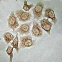 15 - Anti-PAK4/5 Antibody AP54018
