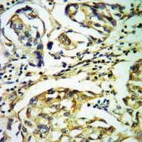 19 - Anti-PAK4/5 Antibody AP54018