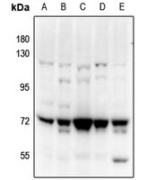 1 - Anti-PAK4/5 Antibody AP54018