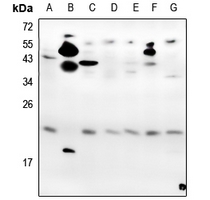 1 - Anti-VEGF165 Antibody AP54020