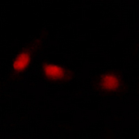 3 - Anti-ATRX Antibody AP54022