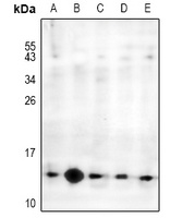 1 - Anti-MED21 Antibody AP54024