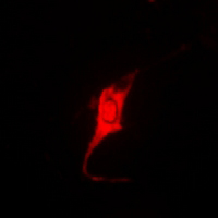3 - Anti-PKI beta Antibody AP54025