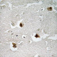 19 - Anti-PKI beta Antibody AP54025