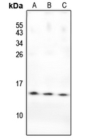 1 - Anti-PKI beta Antibody AP54025