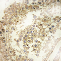 19 - Anti-ECRG4 Antibody AP54026