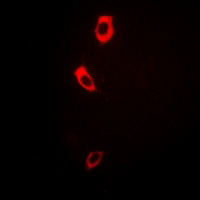 3 - Anti-Collagen 7 alpha 1 Antibody AP54028