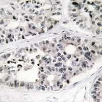 19 - Anti-Collagen 7 alpha 1 Antibody AP54028