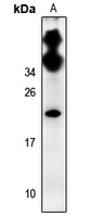 1 - Anti-CDC50C Antibody AP54030