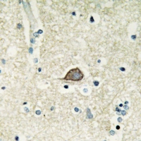19 - Anti-CELSR3 Antibody AP54031