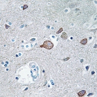 19 - Anti-CEND1 Antibody AP54032