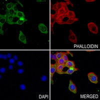 3 - Anti-IGFBP7 Antibody AP54034