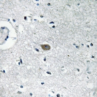 19 - Anti-IGFBP7 Antibody AP54034