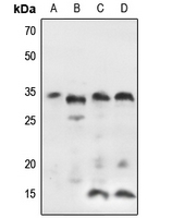 1 - Anti-IGFBP7 Antibody AP54034