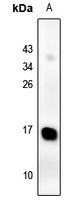 1 - Anti-Galectin 2 Antibody AP54035