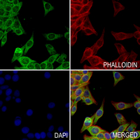 3 - Anti-BAGE2 Antibody AP54037