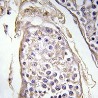 19 - Anti-BAGE3 Antibody AP54038