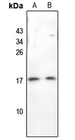 1 - Anti-BAGE3 Antibody AP54038