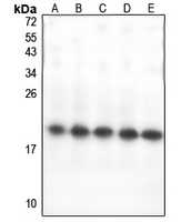 1 - Anti-GPSM3 Antibody AP54041