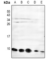 1 - Anti-NDUFC1 Antibody AP54043