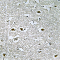 19 - Anti-URB1 Antibody AP54045