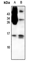 1 - Anti-CCL1 Antibody AP54049