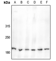 1 - Anti-Nav1.2 Antibody AP54051