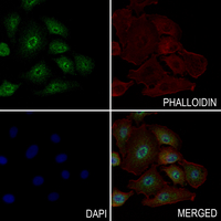 3 - Anti-FOXO1/3/4 (Phospho-T24/32) Antibody AP54057