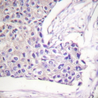 19 - Anti-FOXO1/3/4 (Phospho-T24/32) Antibody AP54057