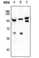 1 - Anti-FOXO1/3/4 (Phospho-T24/32) Antibody AP54057