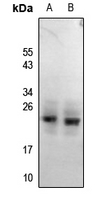 1 - Anti-RGS1/8/16 (Phospho-Y187/159/168) Antibody AP54058