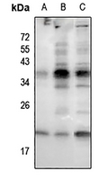 1 - Anti-RAC1/2/3 (Phospho-S71) Antibody AP54059